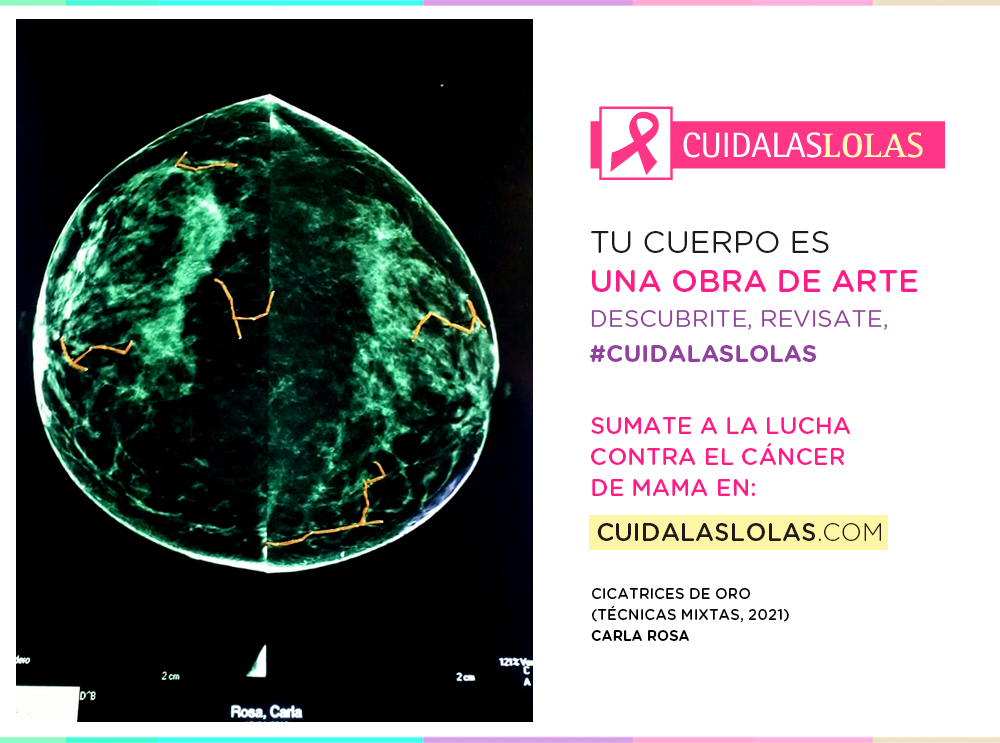 CICATRICES DE ORO