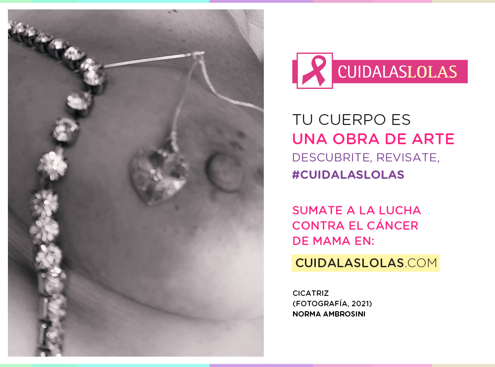 Cicatriz